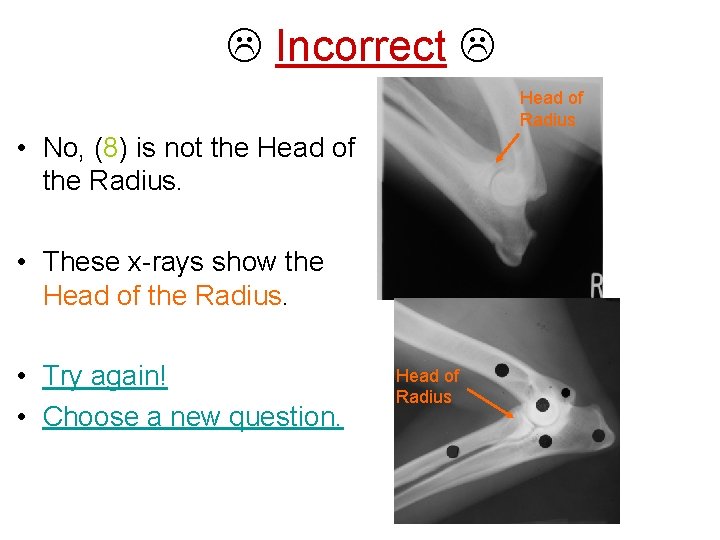  Incorrect Head of Radius • No, (8) is not the Head of the