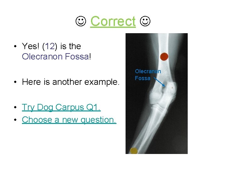  Correct • Yes! (12) is the Olecranon Fossa! • Here is another example.