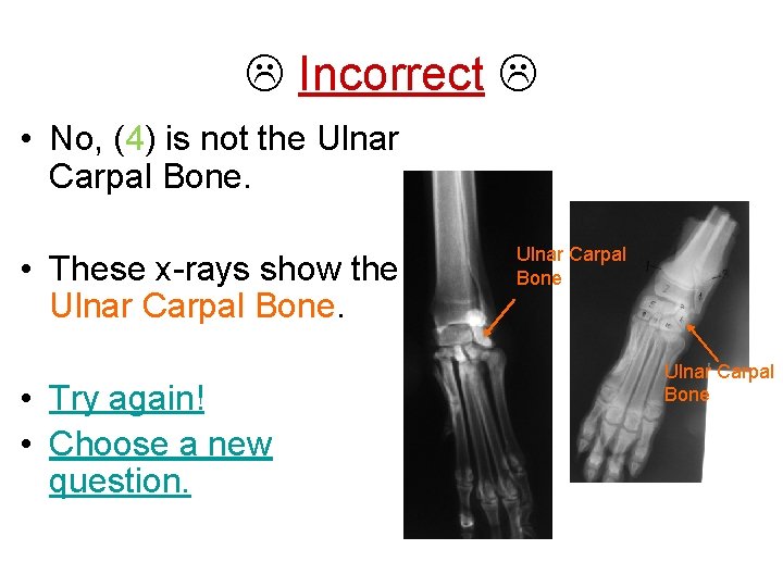  Incorrect • No, (4) is not the Ulnar Carpal Bone. • These x-rays