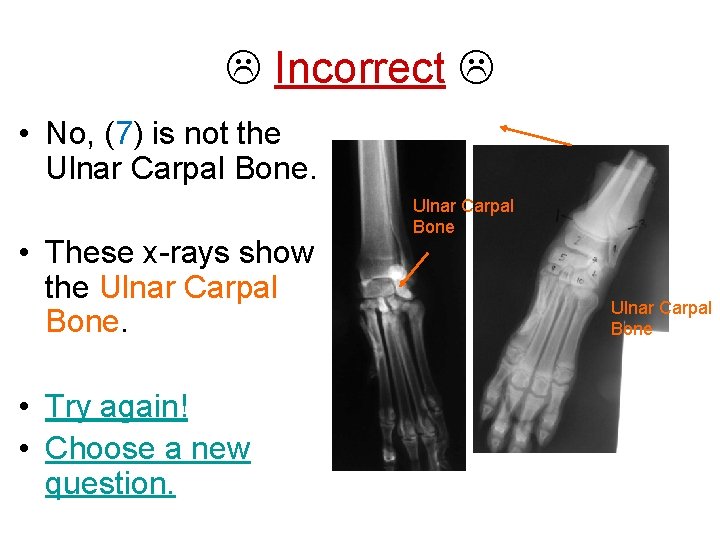  Incorrect • No, (7) is not the Ulnar Carpal Bone. • These x-rays