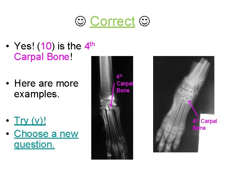  Correct • Yes! (10) is the 4 th Carpal Bone! • Here are