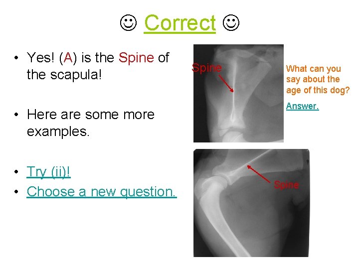  Correct • Yes! (A) is the Spine of the scapula! Spine What can