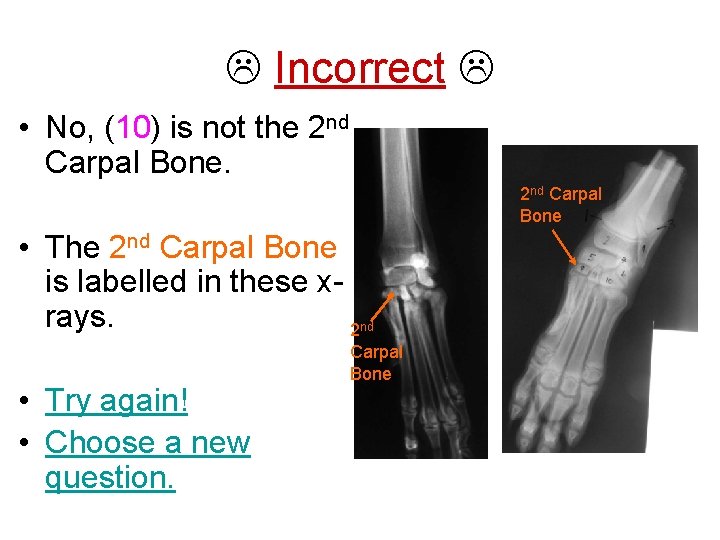  Incorrect • No, (10) is not the 2 nd Carpal Bone • The