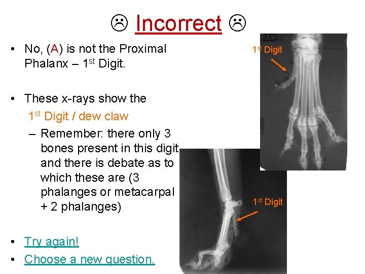  Incorrect • No, (A) is not the Proximal Phalanx – 1 st Digit.