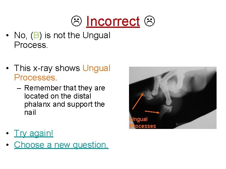  Incorrect • No, (B) is not the Ungual Process. • This x-ray shows