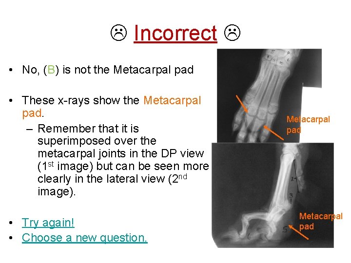  Incorrect • No, (B) is not the Metacarpal pad • These x-rays show