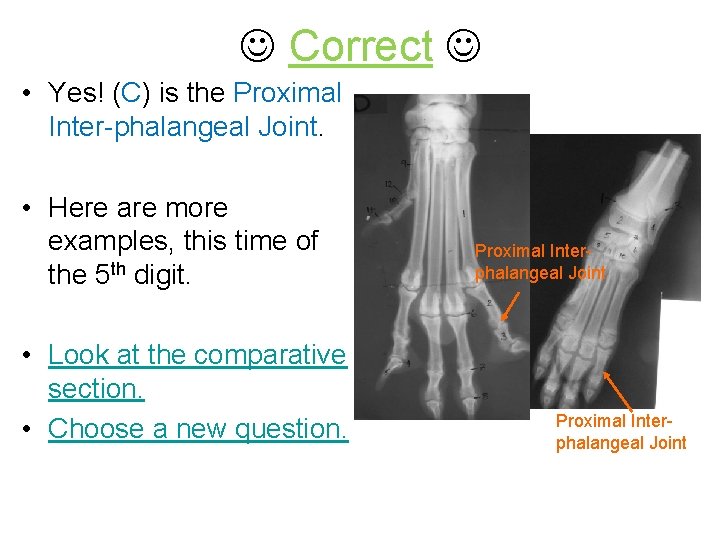  Correct • Yes! (C) is the Proximal Inter-phalangeal Joint. • Here are more