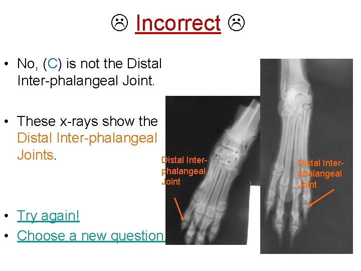  Incorrect • No, (C) is not the Distal Inter-phalangeal Joint. • These x-rays