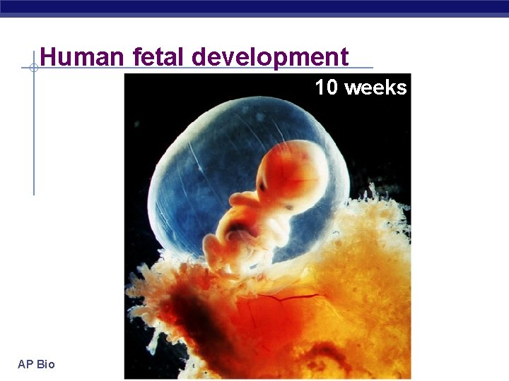 Human fetal development 10 weeks AP Biology 2005 -2006 