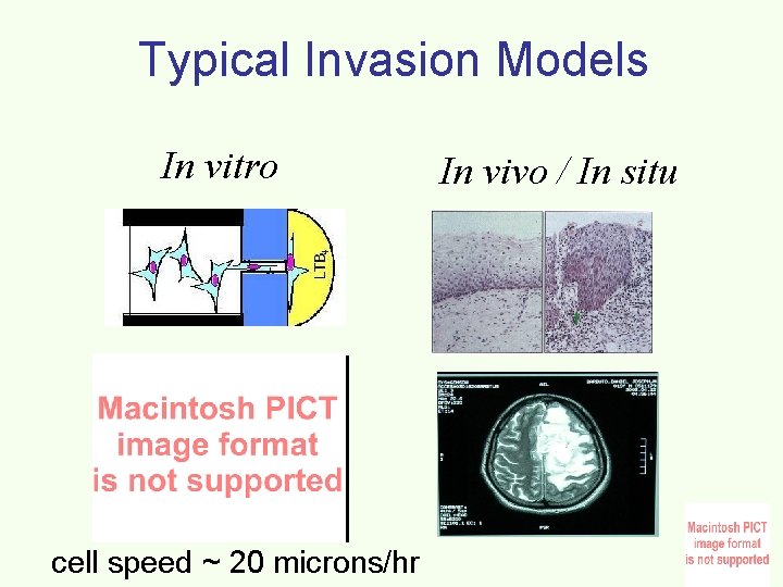 Patterns and Growth of Highly Malignant Brain Tumors
