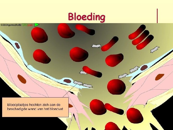 Bloeding 