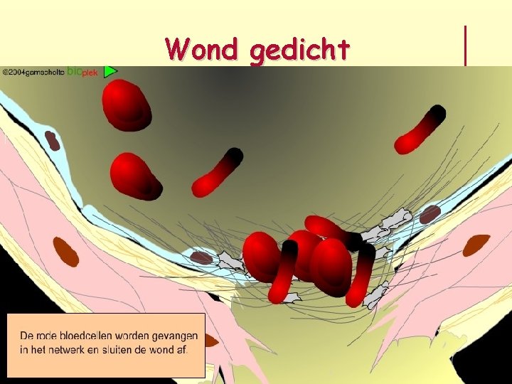 Wond gedicht 