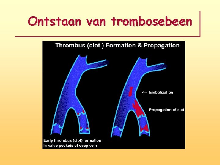 Ontstaan van trombosebeen 
