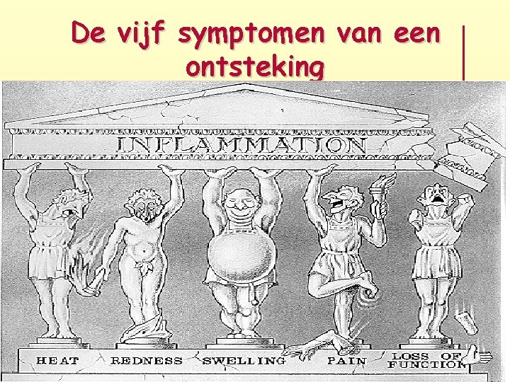 De vijf symptomen van een ontsteking 