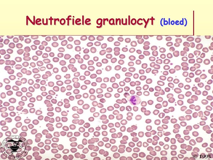 Neutrofiele granulocyt (bloed) 