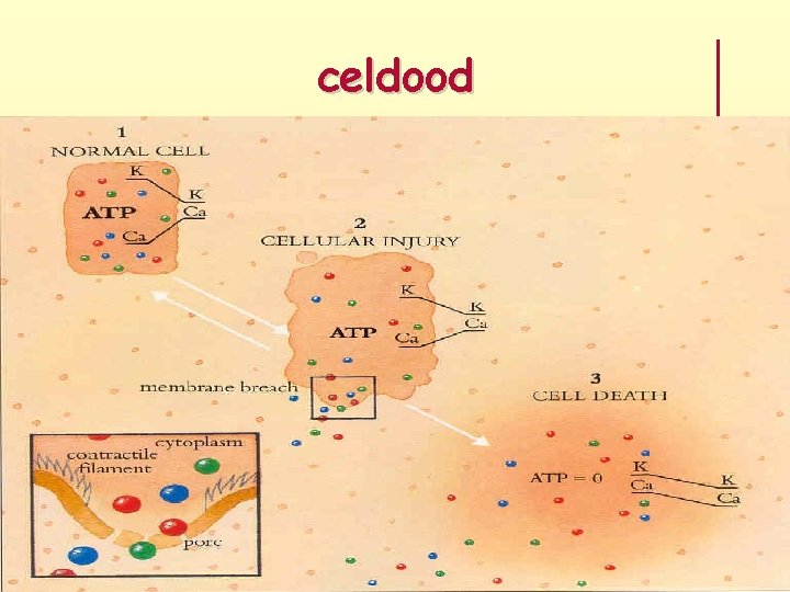 celdood 