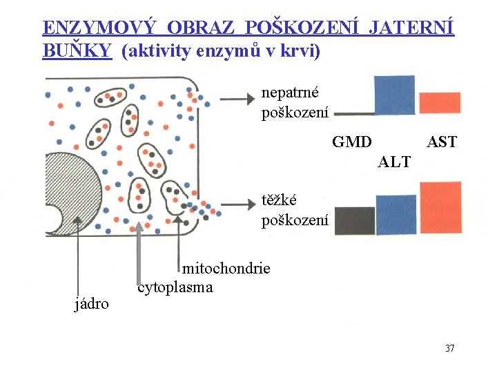 ENZYMOVÝ OBRAZ POŠKOZENÍ JATERNÍ BUŇKY (aktivity enzymů v krvi) nepatrné poškození GMD AST ALT