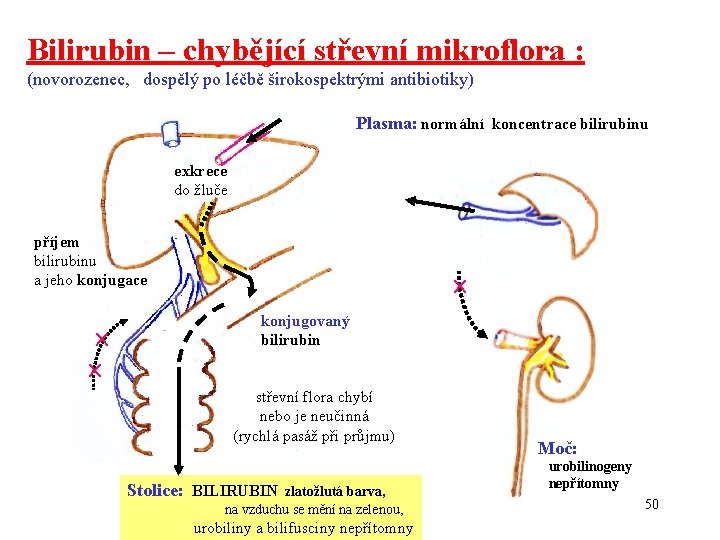 Bilirubin – chybějící střevní mikroflora : (novorozenec, dospělý po léčbě širokospektrými antibiotiky) Plasma: normální