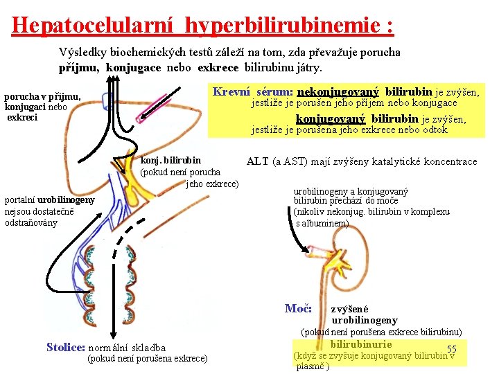 Hepatocelularní hyperbilirubinemie : Výsledky biochemických testů záleží na tom, zda převažuje porucha příjmu, konjugace