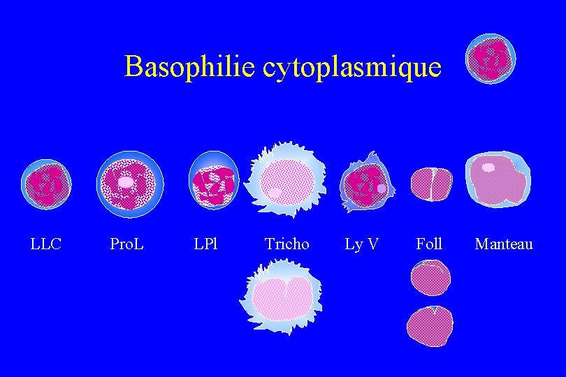 Basophilie cytoplasmique LLC Pro. L LPl Tricho Ly V Foll Manteau 