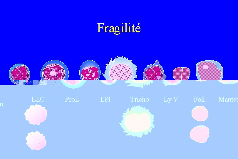 Fragilité LLC Pro. L LPl Tricho Ly V Foll Manteau 
