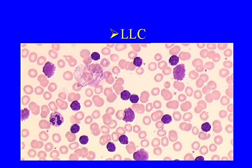 ØLLC 