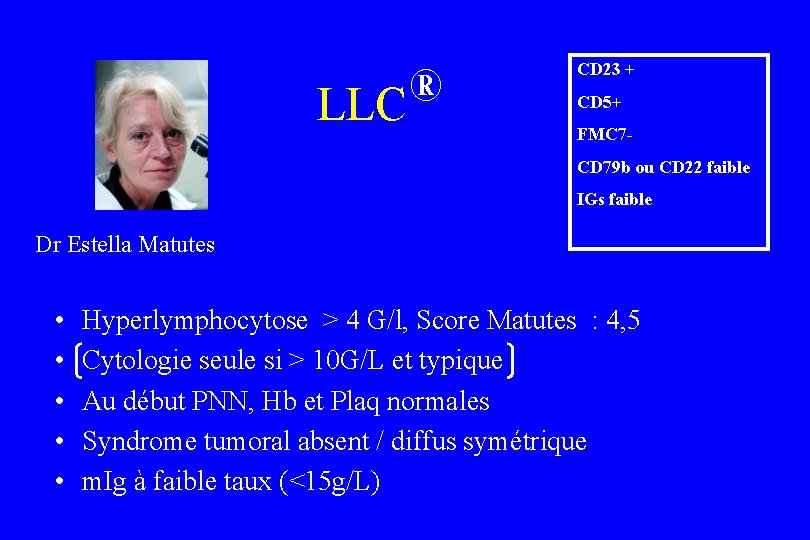® LLC CD 23 + CD 5+ FMC 7 CD 79 b ou CD