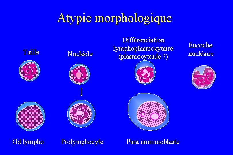 Atypie morphologique Taille Gd lympho Nucléole Prolymphocyte Différenciation lymphoplasmocytaire (plasmocytoïde ? ) Para immunoblaste