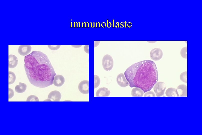 immunoblaste 