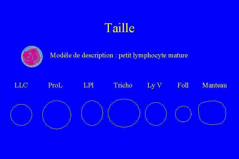 Taille Modèle de description : petit lymphocyte mature LLC Pro. L LPl Tricho Ly