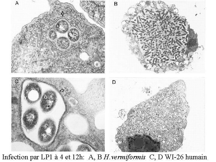 Infection par LP 1 à 4 et 12 h: A, B H. vermiformis C,