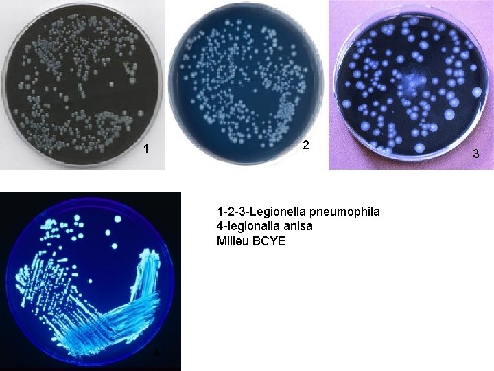 2 1 1 -2 -3 -Legionella pneumophila 4 -legionalla anisa Milieu BCYE 4 3