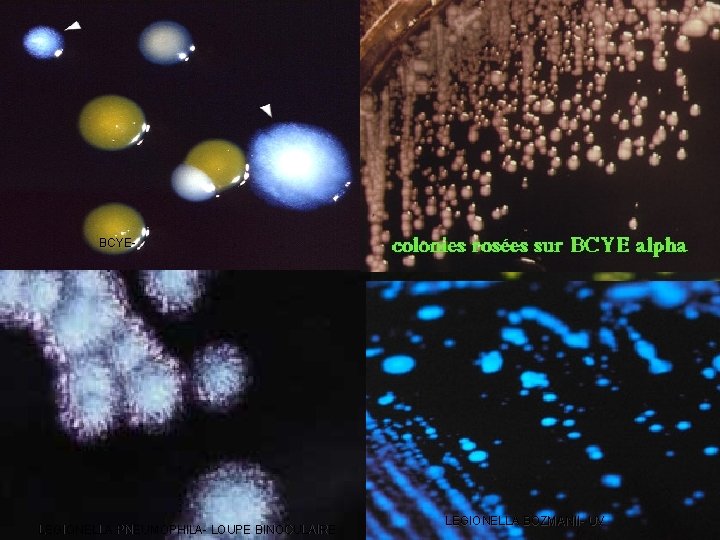 BCYE- LEGIONELLA PNEUMOPHILA- LOUPE BINOCULAIRE LEGIONELLA BOZMANII- UV 