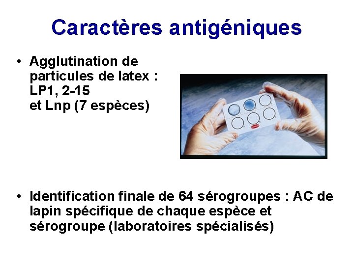 Caractères antigéniques • Agglutination de particules de latex : LP 1, 2 -15 et