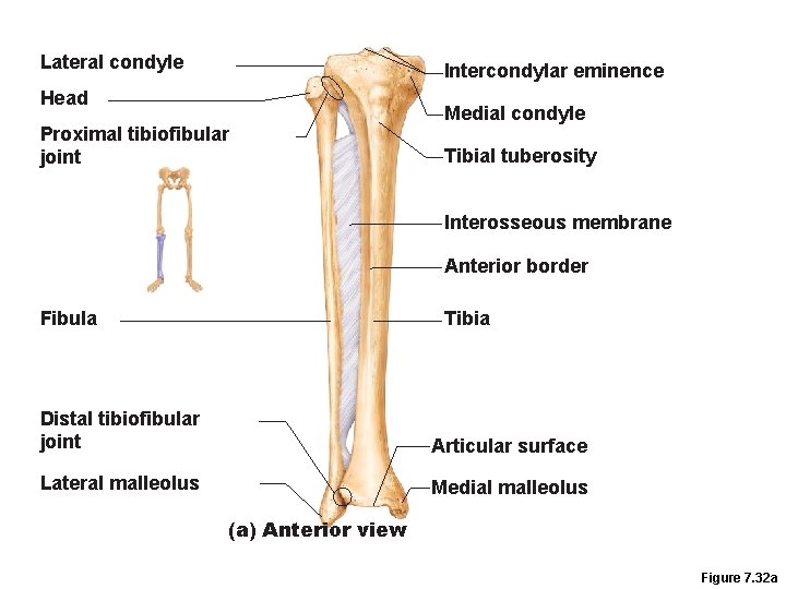 Lateral condyle Intercondylar eminence Head Proximal tibiofibular joint Medial condyle Tibial tuberosity Interosseous membrane