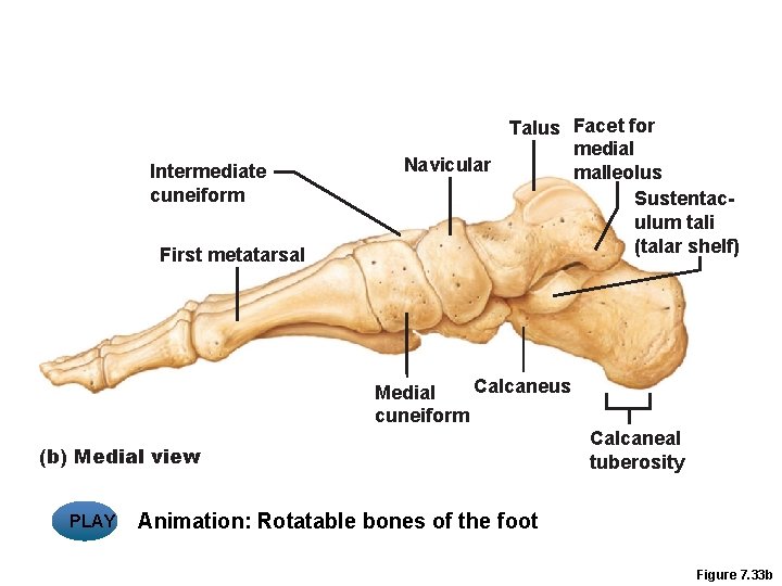 Intermediate cuneiform First metatarsal Talus Facet for medial Navicular malleolus Sustentaculum tali (talar shelf)