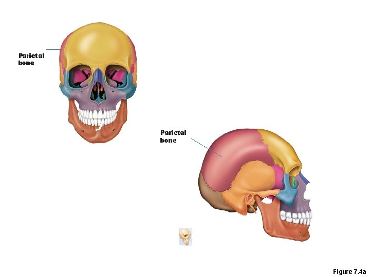 Parietal bone Figure 7. 4 a 