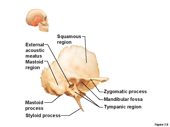 External acoustic meatus Mastoid region Squamous region Zygomatic process Mastoid process Mandibular fossa Tympanic