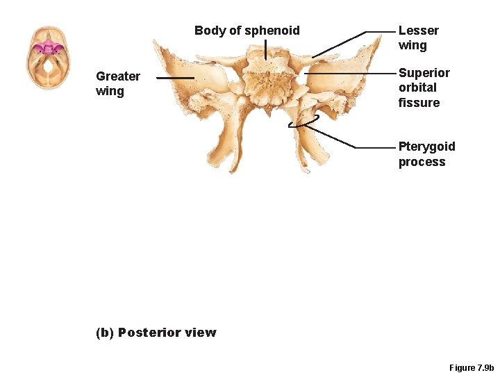 Body of sphenoid Greater wing Lesser wing Superior orbital fissure Pterygoid process (b) Posterior