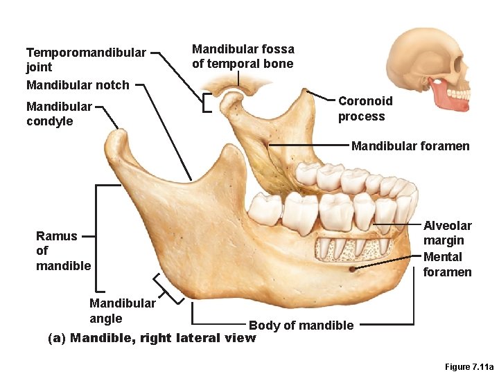 Temporomandibular joint Mandibular notch Mandibular condyle Mandibular fossa of temporal bone Coronoid process Mandibular