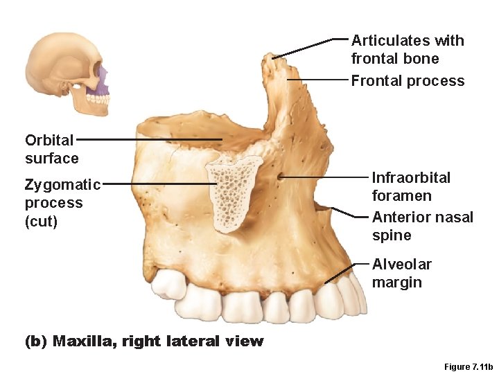 Articulates with frontal bone Frontal process Orbital surface Zygomatic process (cut) Infraorbital foramen Anterior