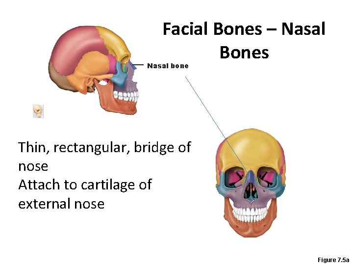 Facial Bones – Nasal Bones Nasal bone Thin, rectangular, bridge of nose Attach to
