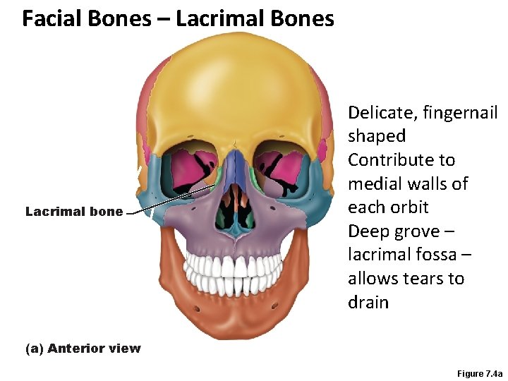 Facial Bones – Lacrimal Bones Lacrimal bone Delicate, fingernail shaped Contribute to medial walls