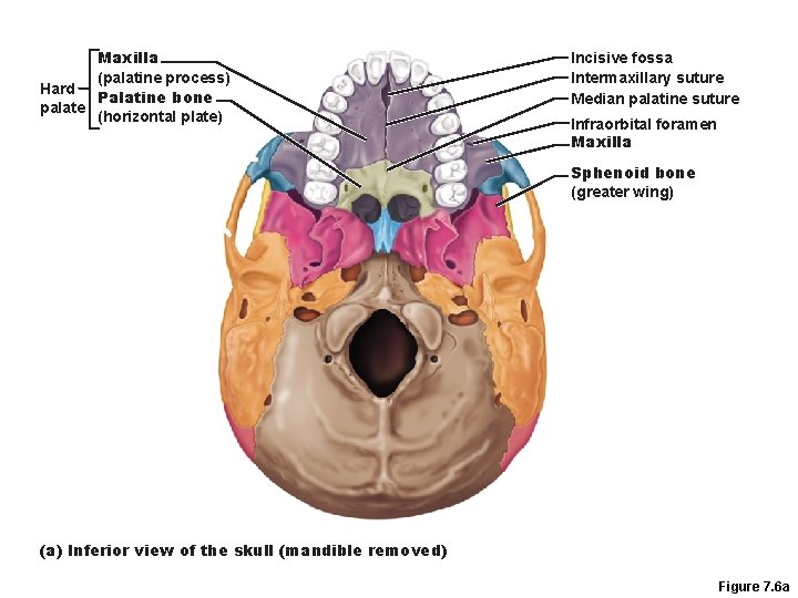 Maxilla (palatine process) Hard Palatine bone palate (horizontal plate) Incisive fossa Intermaxillary suture Median