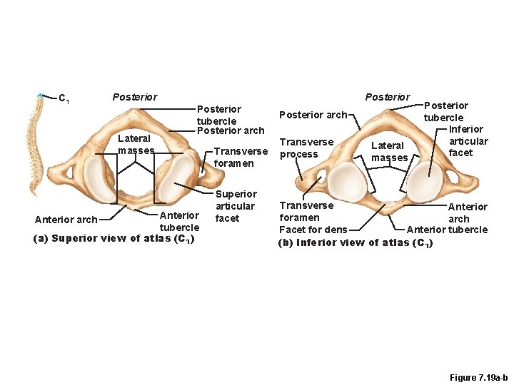 C 1 Posterior Lateral masses Posterior tubercle Posterior arch Anterior arch tubercle (a) Superior
