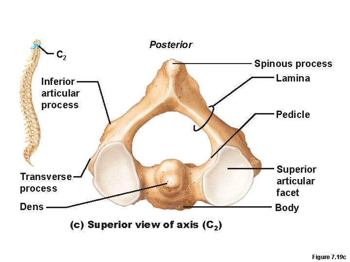 Posterior C 2 Inferior articular process Spinous process Lamina Pedicle Transverse process Superior articular