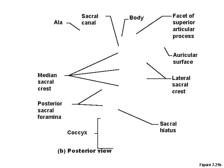 Ala Sacral canal Body Facet of superior articular process Auricular surface Median sacral crest