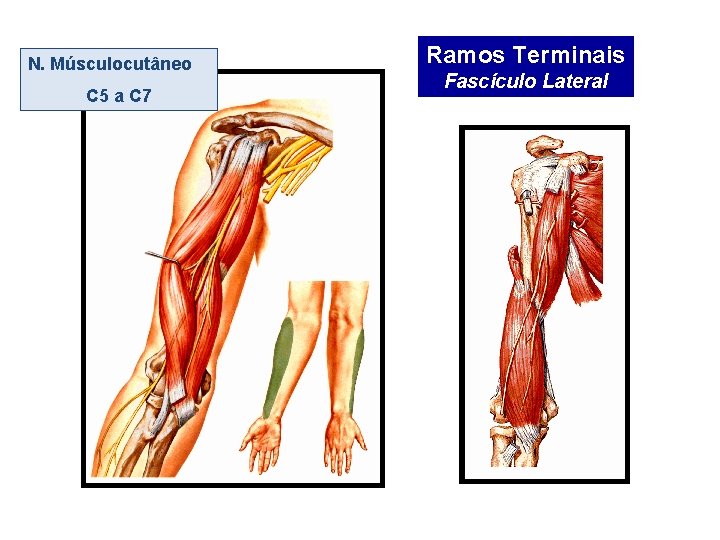 N. Músculocutâneo C 5 a C 7 Ramos Terminais Fascículo Lateral 