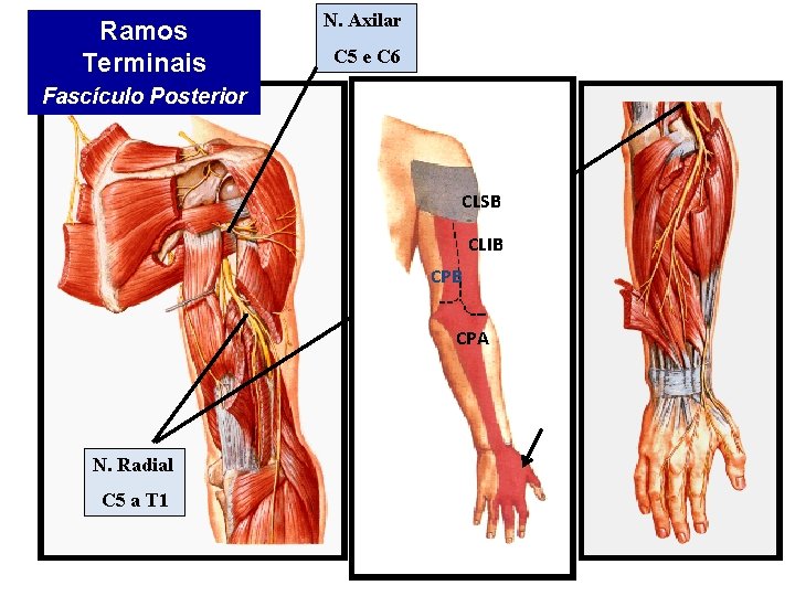 Ramos Terminais N. Axilar C 5 e C 6 Fascículo Posterior CLSB CLIB CPA