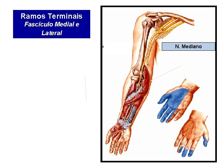 Ramos Terminais Fascículo Medial e Lateral N. Mediano 